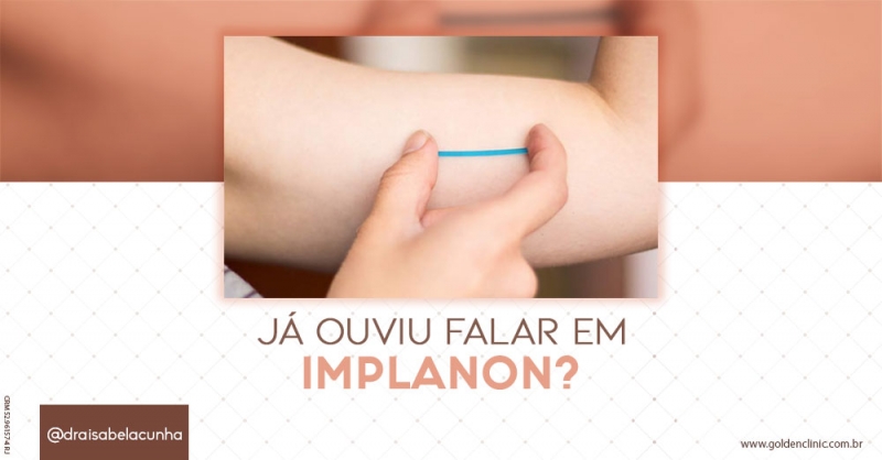 Já ouviu falar em Implanon?